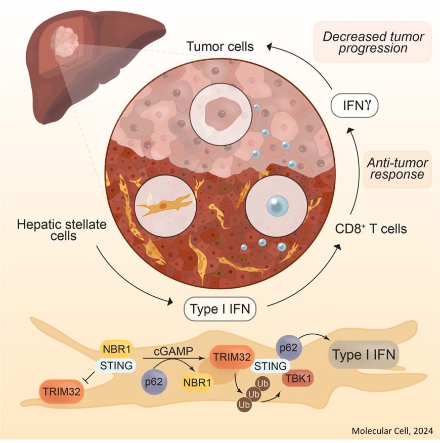 Mechanism of progression of hepatocellular carcinoma