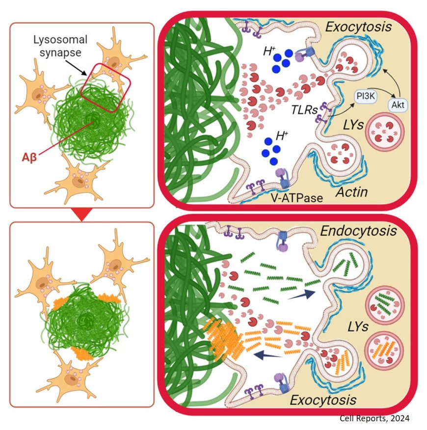 How microglia degrade large Alzheimer’s amyloid-beta plaques?