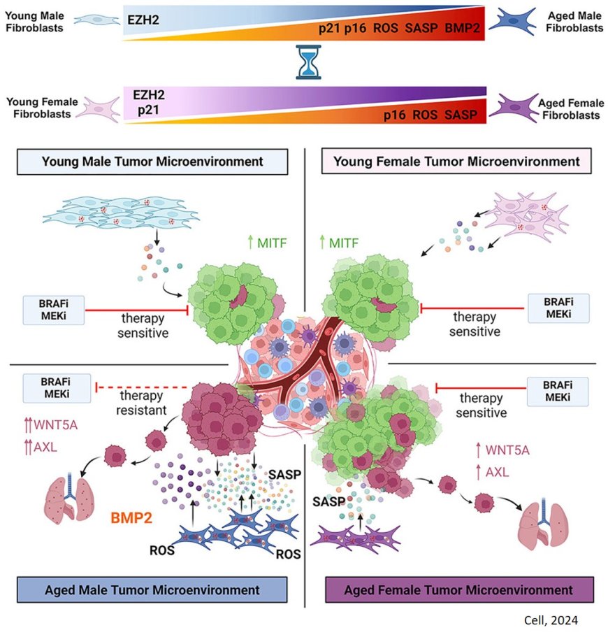 Sex disparity in cutaneous melanoma