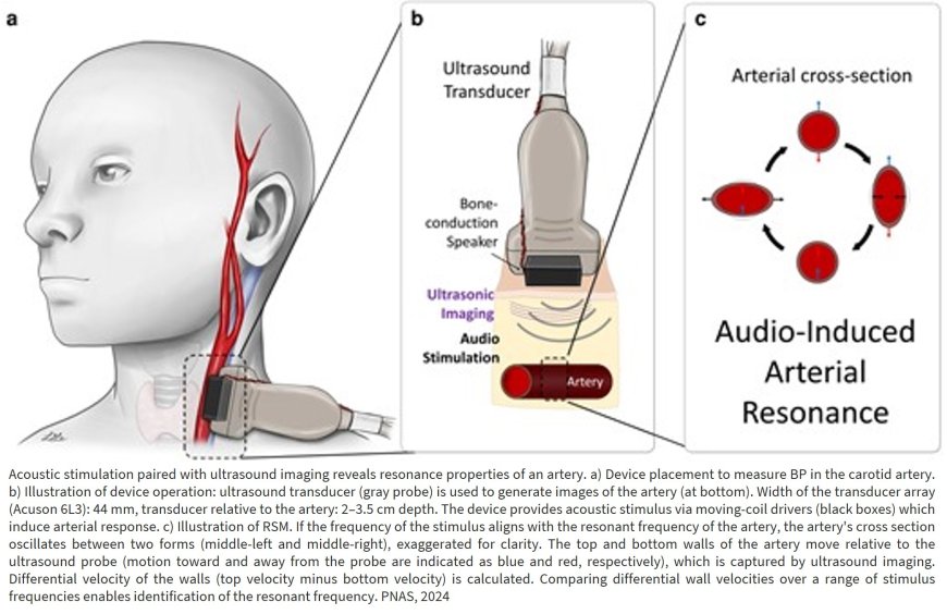 First noninvasive method to continually measure true blood pressure