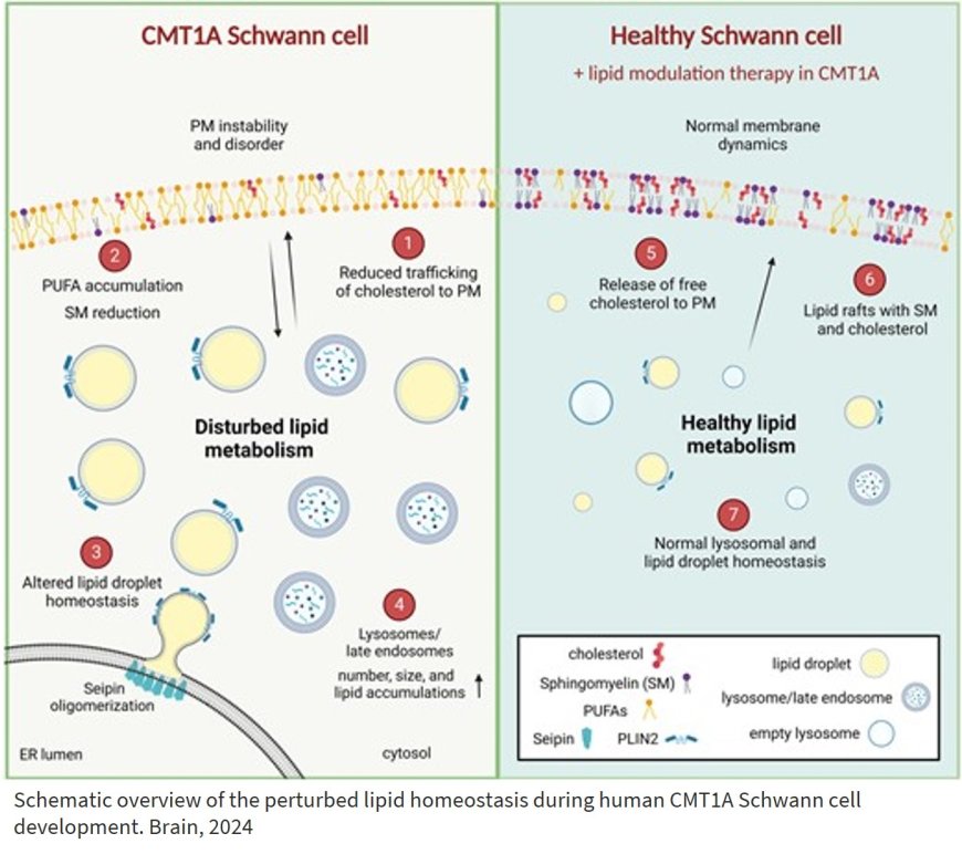 Human Schwann cell lipid dysregulation and plasma membrane perturbation in Charcot–Marie–Tooth disease type 1A disease