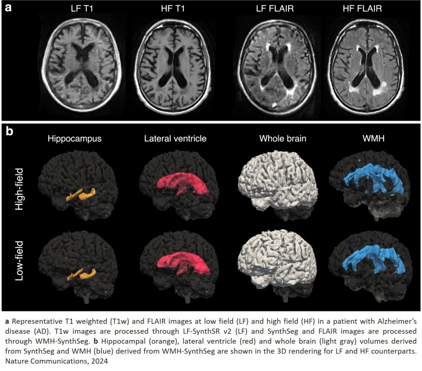 Portable, low-field magnetic resonance imaging for evaluation of Alzheimer’s disease