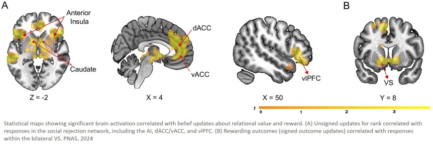 Neural responses to social rejection reflect dissociable learning about relational value and reward