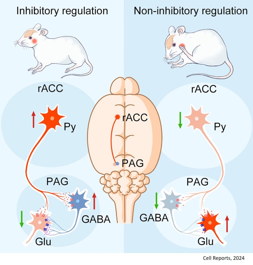 An excitatory neural circuit for descending inhibition of itch processing