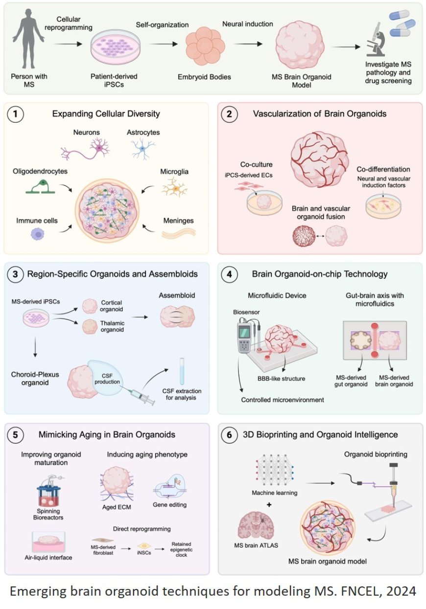 Brain organoid methodologies to explore mechanisms of disease in progressive multiple sclerosis