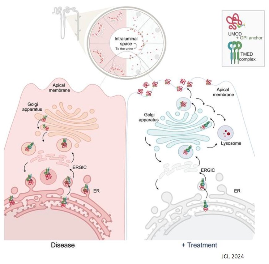 Disrupted uromodulin trafficking is rescued by targeting TMED cargo receptors