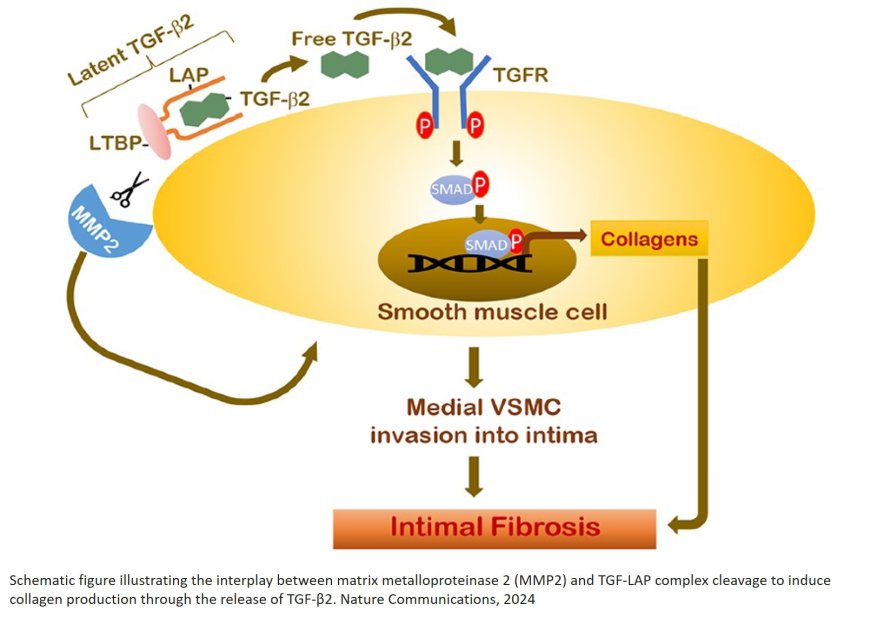 A new mechanism for type 2 diabetes-associated atherosclerosis