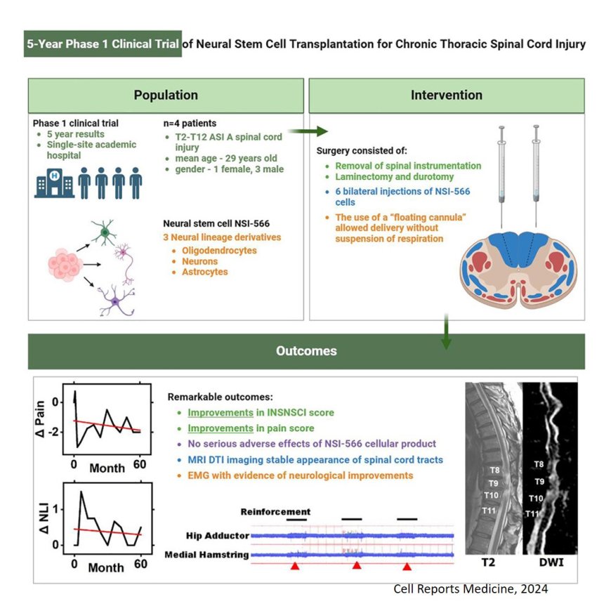 Neural stem cell transplantation shows promise for treating chronic spinal cord injury