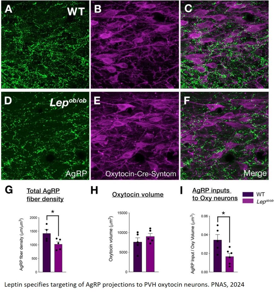 AgRP neurons mediate activity-dependent development of oxytocin connectivity and autonomic regulation