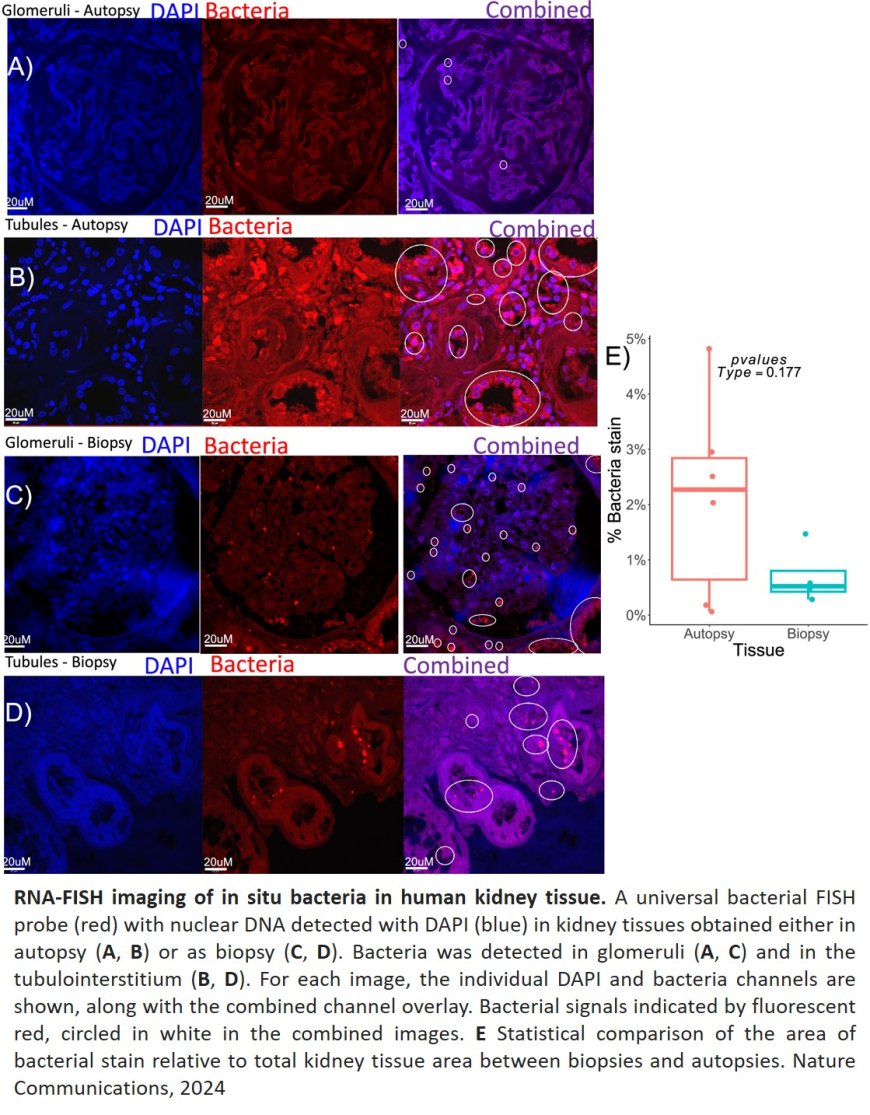 Cefazolin shifts the kidney microbiota to promote a lithogenic environment