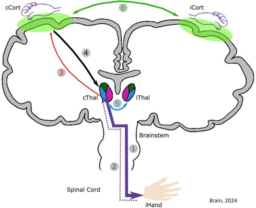 Treating essential tremor (ET) with deep brain stimulation