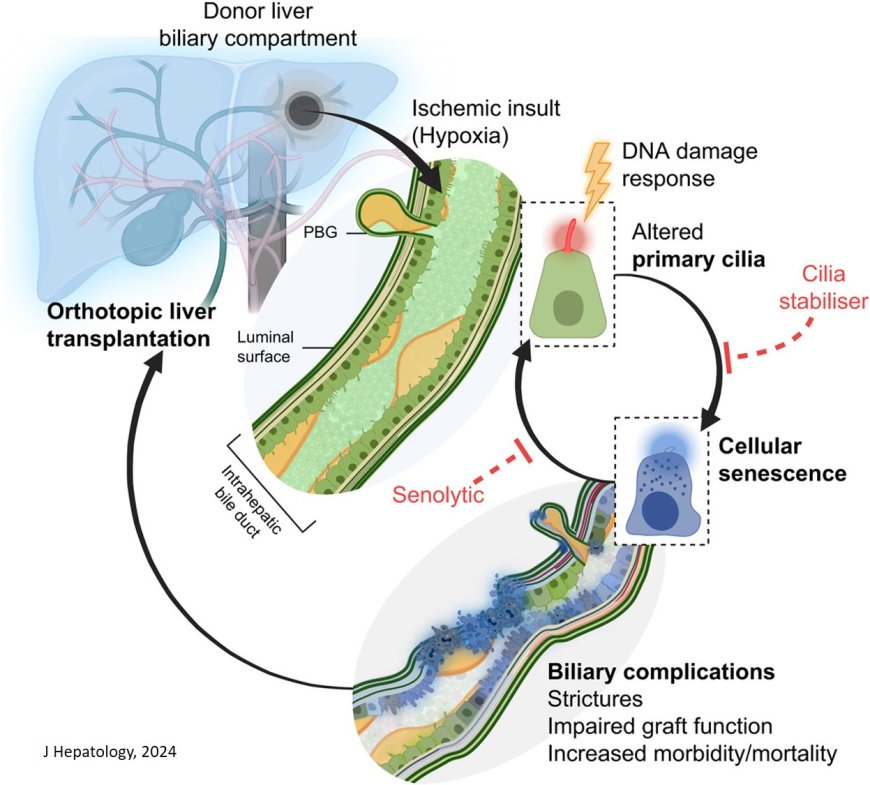 Primary cilia as a targetable node between biliary injury, senescence and regeneration in liver transplantation