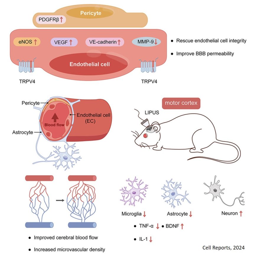 Low-intensity pulsed ultrasound modulates disease progression in ALS