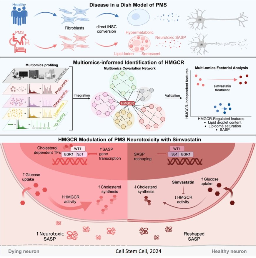 Increased cholesterol synthesis drives neurotoxicity in multiple sclerosis