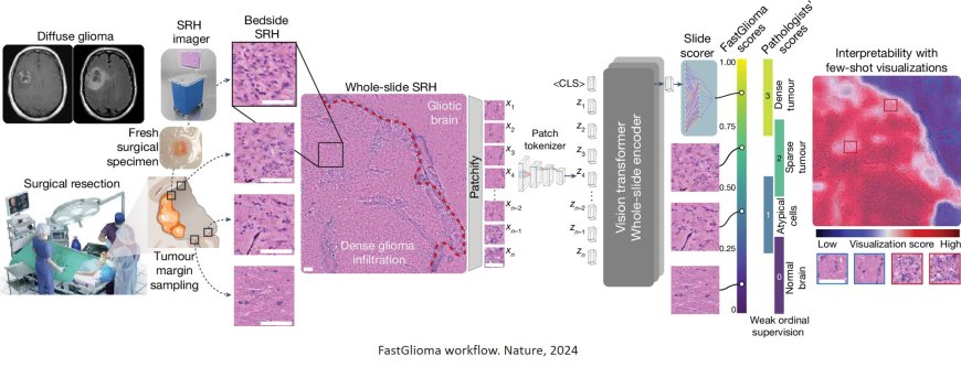 Foundation models for fast, label-free detection of glioma infiltration