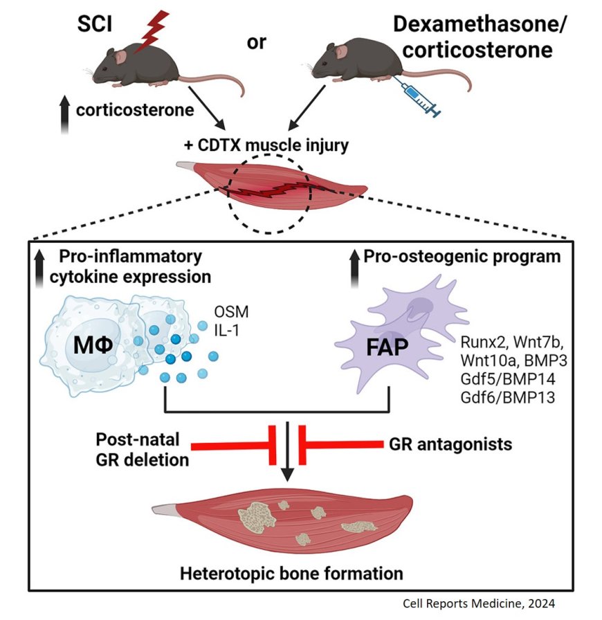 A glucocorticoid spike derails muscle repair to heterotopic ossification after spinal cord injury