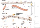 Gut microbiota and Alzheimer’s disease
