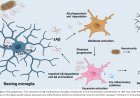 Microglia in Alzheimer’s disease