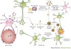 Different types of Alzheimer's disease