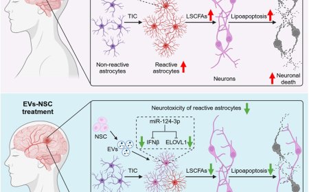 How extracellular vesicles from neural stem cells protect against intracerebral hemorrhage