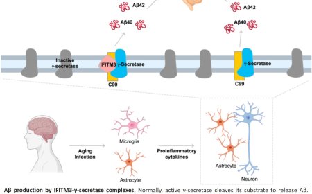 γ-Secretase in Alzheimer’s disease