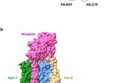 Gamma secretase in Alzheimer's disease