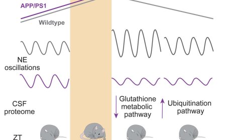 Sleep deprivation in Alzheimer model