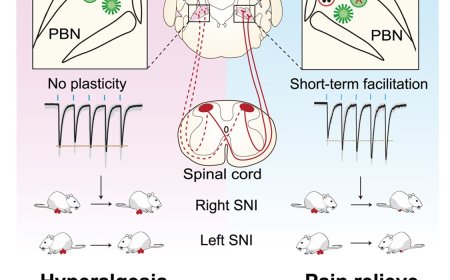Right parabrachial nucleus mediates early-phase neuropathic pain development