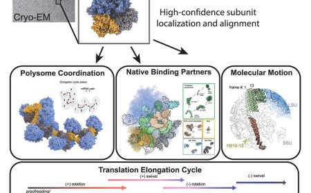 Structural dynamics of human ribosomes in situ