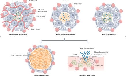 Macrophage heterogeneity in tuberculosis