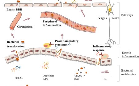 Gut microbiota and Alzheimer’s disease