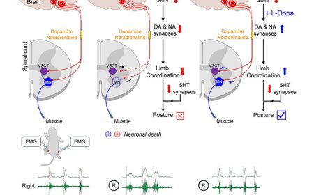Postural and locomotor deficits in spinal muscular atrophy