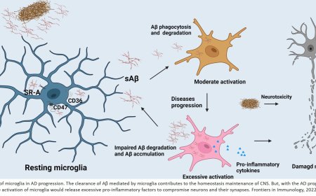 Microglia in Alzheimer’s disease