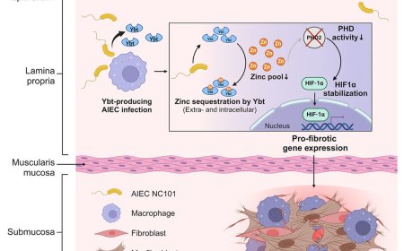 How intestinal E. coli promotes profibrotic macrophages in Crohn’s disease