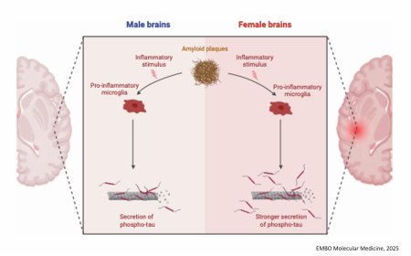 Sex dependent alteration in Alzheimer’s pathology