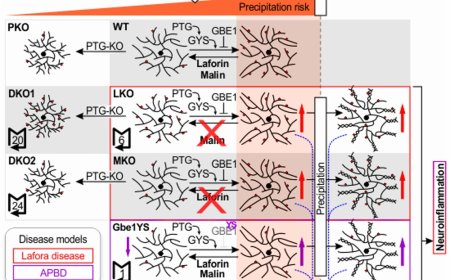 Glycogen synthase GYS1 overactivation contributes to neurodegenerative disease