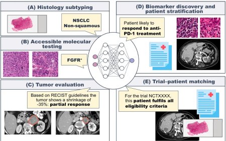 AI-based biomarkers for treatment decisions in oncology