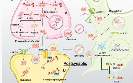 Comorbidity and progression of late onset Alzheimer’s disease: A systematic review