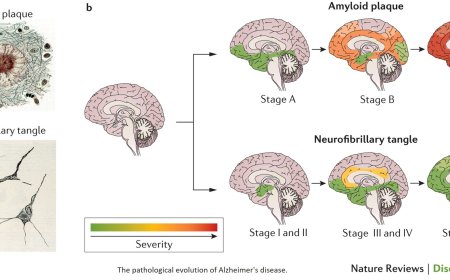 Late-Onset Alzheimer's Disease (LOAD)