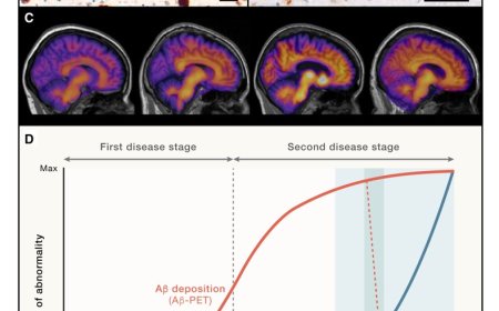 Alzheimer’s disease: From immunotherapy to immunoprevention