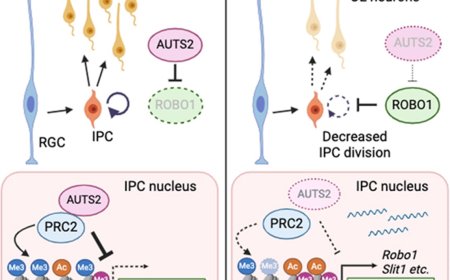 Mechanism of microcephaly development by the deletion of transcriptional regulator