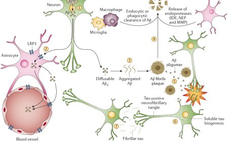 Different types of Alzheimer's disease
