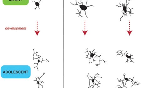 Early life stress effect on microglia morphology in the developing primate amygdala