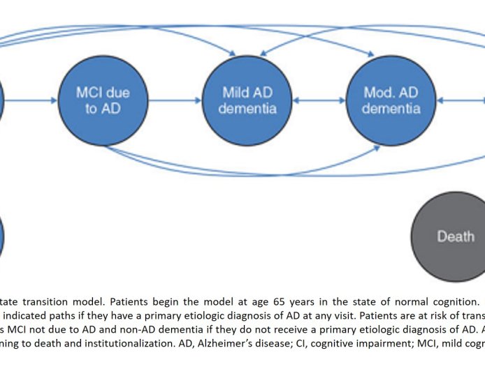 How does Alzheimer's disease progress over time?
