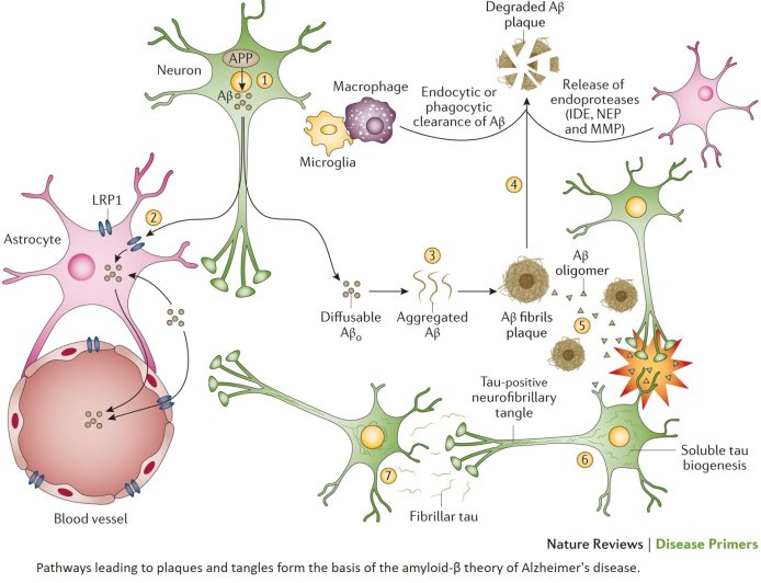 Different types of Alzheimer's disease