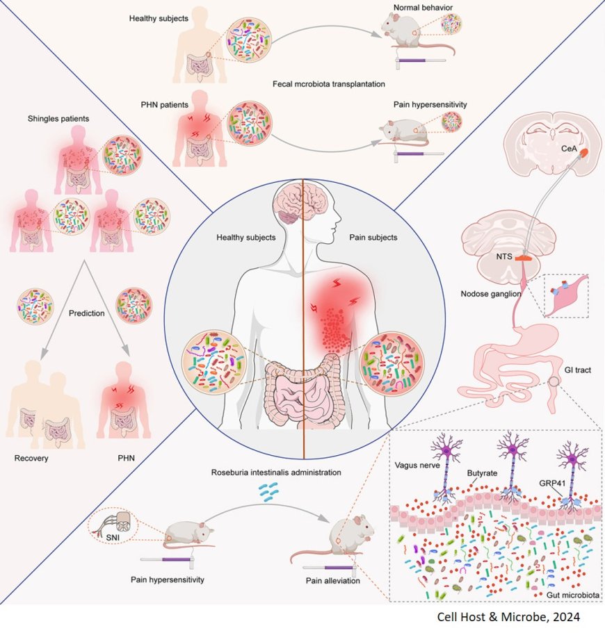 Neuropathic pain relief from gut microbe!