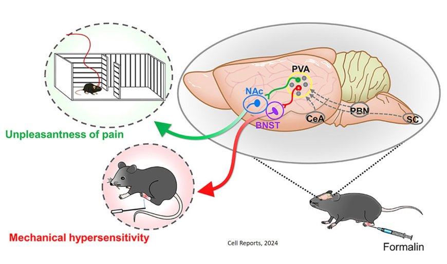 Regulating sensory and affective aspects of pain