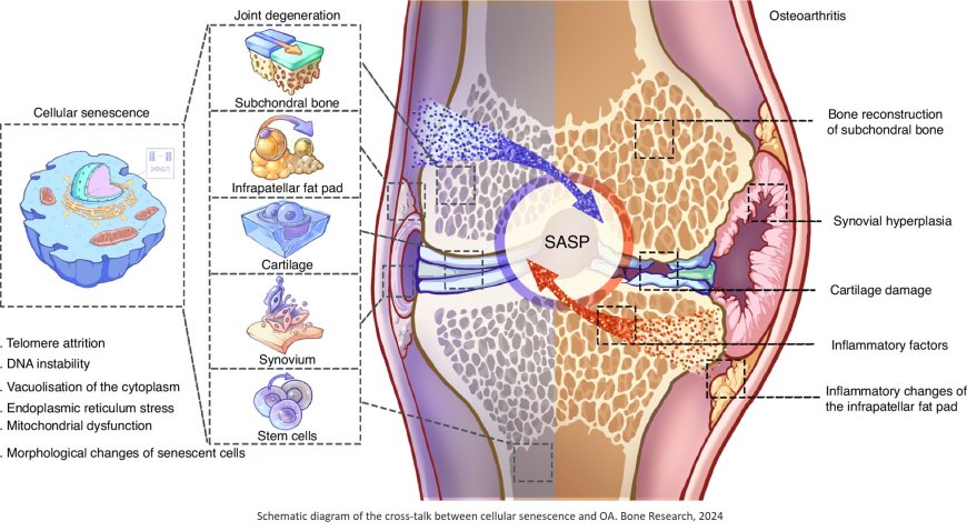 Cross-talk of inflammation and cellular senescence in osteoarthritis