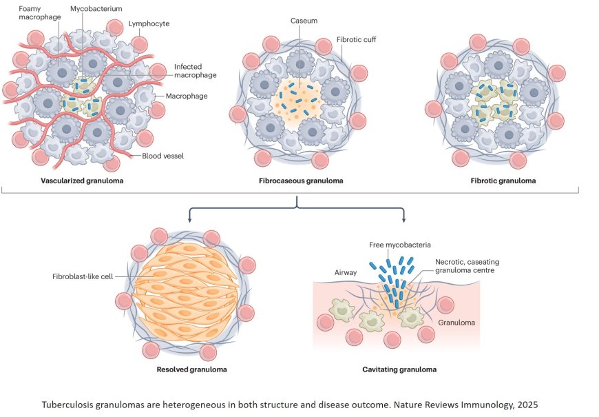 Macrophage heterogeneity in tuberculosis