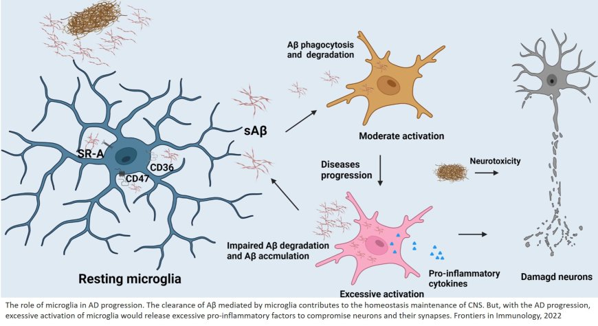 Microglia in Alzheimer’s disease